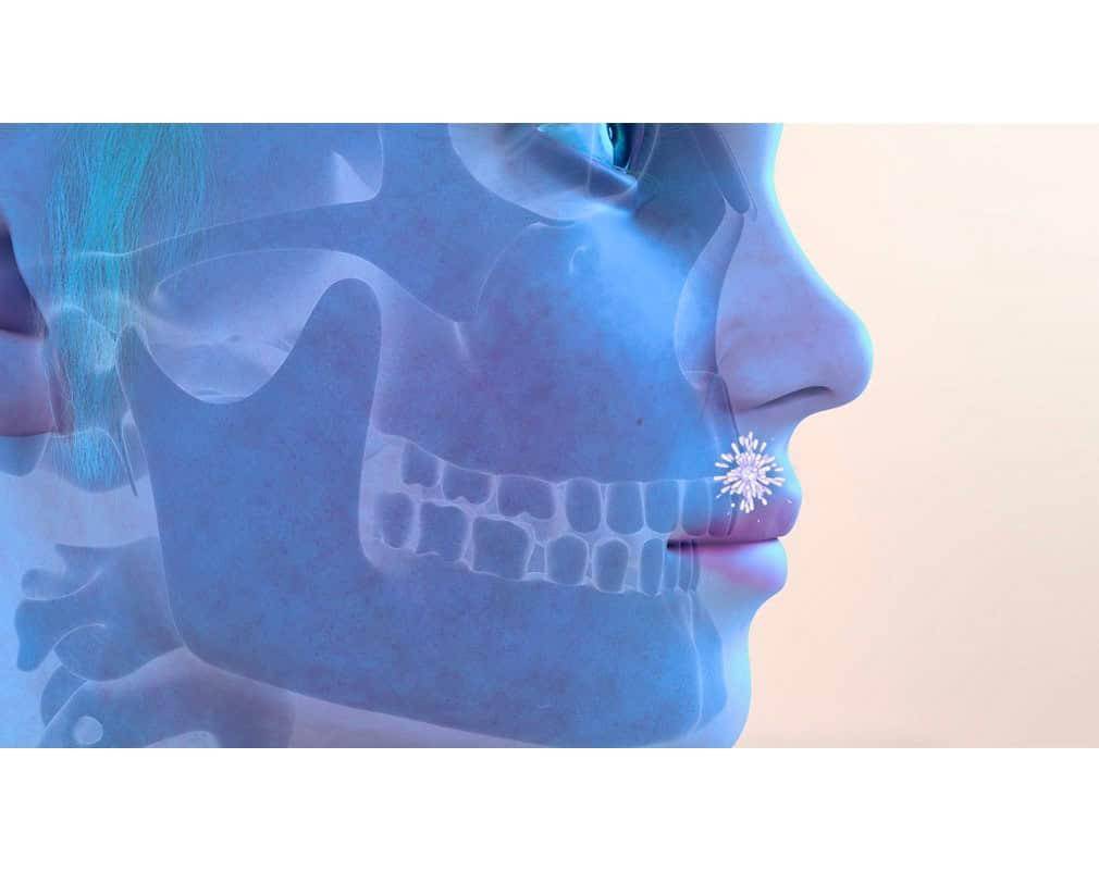Virpax : action d'aciclovir dans la salive